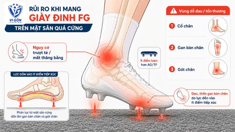rủi ro trượt té khi dùng đinh FG trên sân nhân tạo